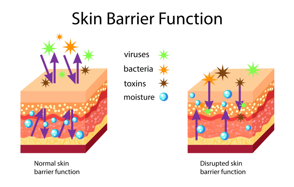 Skin barrier Repair